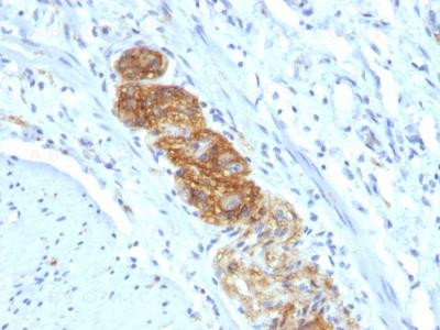 Anti-CD56 / NCAM1 / NKH1 (Neuronal Cell Marker)(Clone: NCAM1/784)