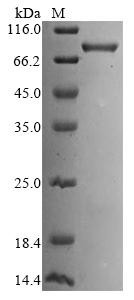 Kelch-like ECH-associated protein 1 (KEAP1), human, recombinant