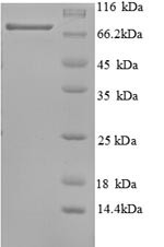 Tumor protein 63 (TP63), human, recombinant