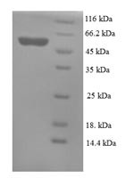 Mesothelin (Msln), partial, mouse, recombinant