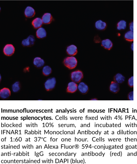 Anti-IFNAR1 Rabbit Monoclonal Antibody (Clone 110)