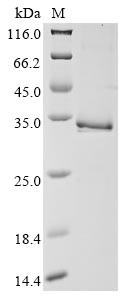 Tryptase beta-2 (TPSB2), human, recombinant