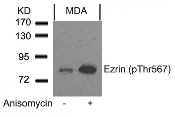 Anti-phospho-Ezrin (Thr567)