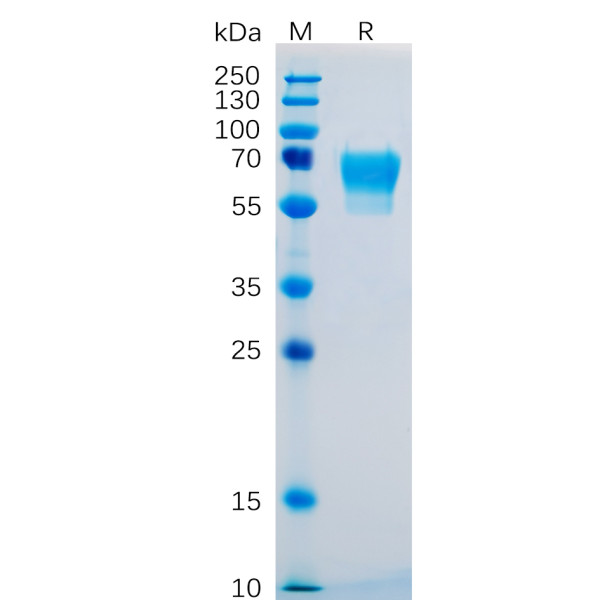 Human CD27 Protein, hFc Tag