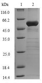 Fructose-1,6-bisphosphatase 1 (FBP1), human, recombinant