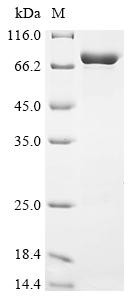 Heat shock protein HSP70 (HSP70), Toxoplasma gondii, recombinant