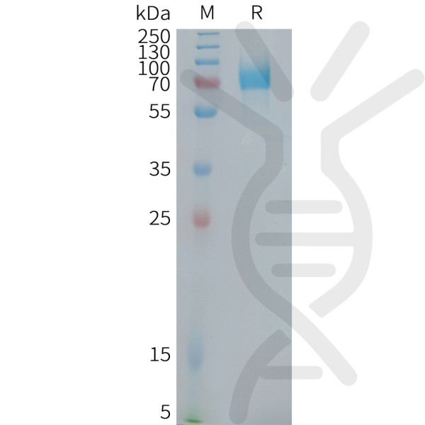 Human CD22(417-678) Protein, mFc Tag