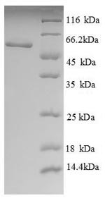 Phosphatidylcholine-sterol acyltransferase (LCAT), partial, human, recombinant