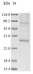 Adiponectin receptor protein 1 (ADIPOR1), partial, human, recombinant