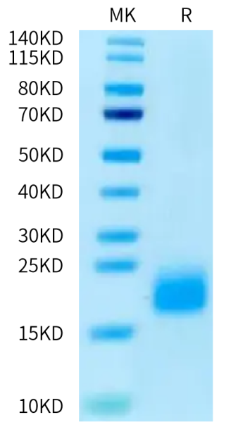 Human ACVR1B/ALK-4 Protein