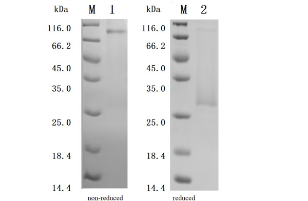 CD70 antigen (CD70), partial (Active), human, recombinant