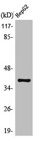 Anti-MCL1