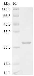 Serine/threonine-protein kinase TBK1 (TBK1), partial, human, recombinant