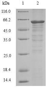 Receptor-interacting serine/threonine-protein kinase 3 (RIPK3), human, recombinant