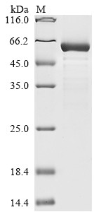 14-3-3 protein sigma (SFN), human, recombinant