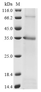 Sodium/potassium-transporting ATPase subunit beta-1 (Atp1b1), mouse, recombinant