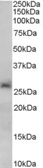 Anti-SIRT3, C-terminal