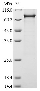 Receptor-interacting serine/threonine-protein kinase 1 (RIPK1), human, recombinant