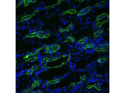 Anti-Aquaporin 3