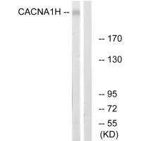 Anti-CACNA1H