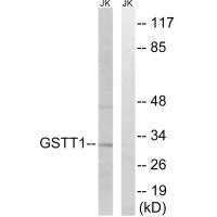 Anti-GSTT1/GSTT4