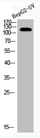 Anti-Acetyl-XPO1 (K568)