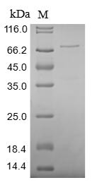 X-ray repair cross-complementing protein 5 (XRCC5), partial, human, recombinant