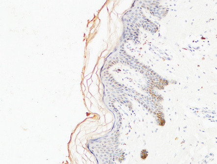 Anti-COL1A1 Monoclonal