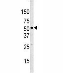 Anti-JMJD2D (KDM4D)