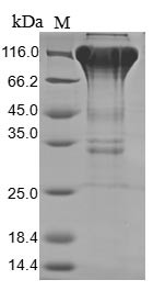 Macrophage colony-stimulating factor 1 receptor (CSF1R), partial, human, recombinant