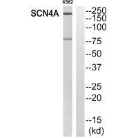 Anti-SCN4A