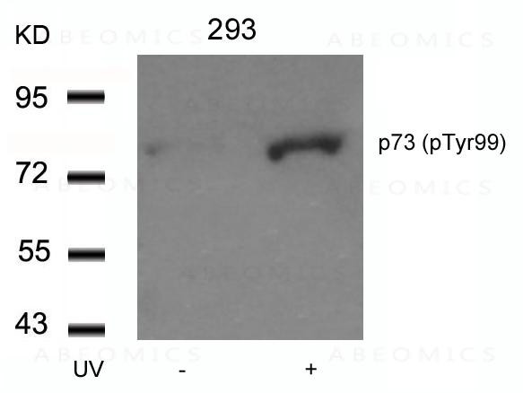 Anti-phospho-p73 (Tyr99)
