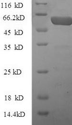 CCN family member 2 (Ccn2), partial, mouse, recombinant