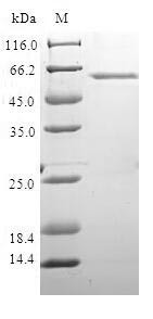 DNA repair protein XRCC4 (XRCC4), human, recombinant