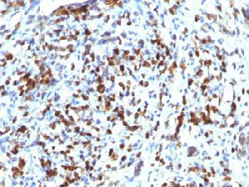 Anti-MyoD1 (Rhabdomyosarcoma Marker) Recombinant Rabbit Monoclonal Antibody (clone:MYOD1/2075R)