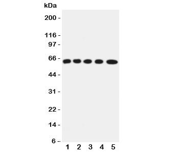 Anti-OCTN2 SLC22A5