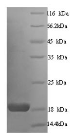 Calmodulin (CALM1), human, recombinant