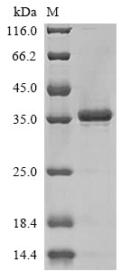 CCN family member 2 (CCN2), human, recombinant