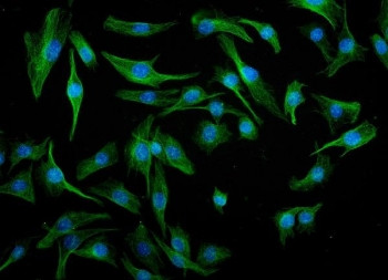 Anti-Irf3 / Interferon regulatory factor 3, clone 11H2