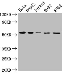 Anti-SLC16A1 Recombinant Monoclonal, clone 9D12