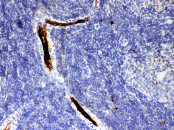 Anti-alpha 1 Antitrypsin