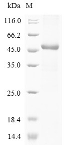Transient receptor potential cation channel subfamily V member 1 (TRPV1), partial, human, recombinan