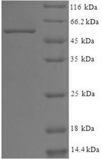 WD repeat-containing protein 5 (WDR5), human, recombinant