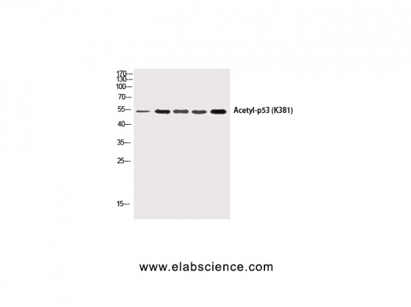 Anti-Acetyl-p53 (Lys381)