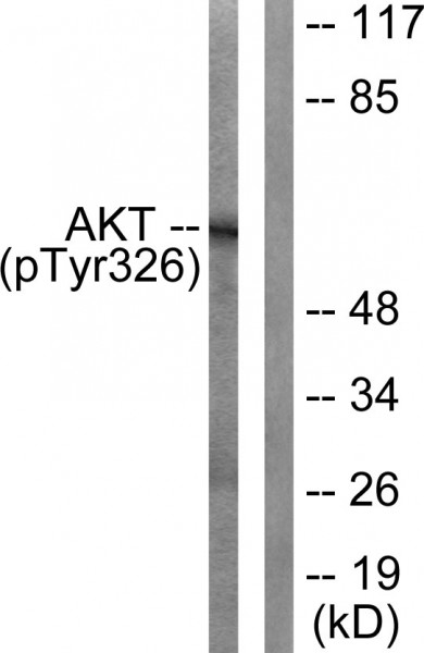 Anti-phospho-Akt (Tyr326)