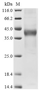 Short transient receptor potential channel 6 (TRPC6), partial, human, recombinant