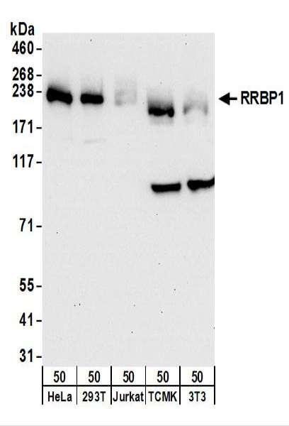 Anti-RRBP1