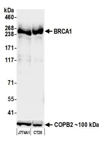 Anti-BRCA1 Recombinant Monoclonal