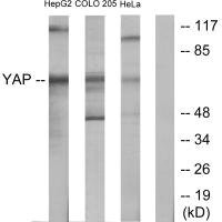 Anti-YAP1