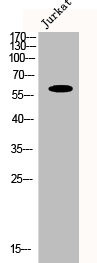 Anti-CYP1B1